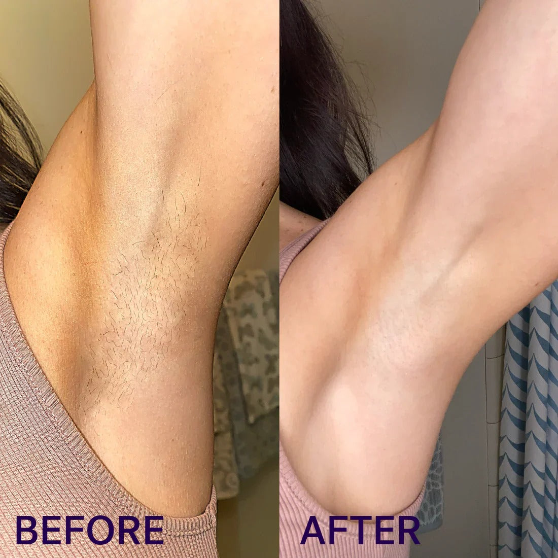 Gentle Hair Removal Cream Duo ✨ Smooth Skin, No Pain — Perfect for Sensitive Skin 💜