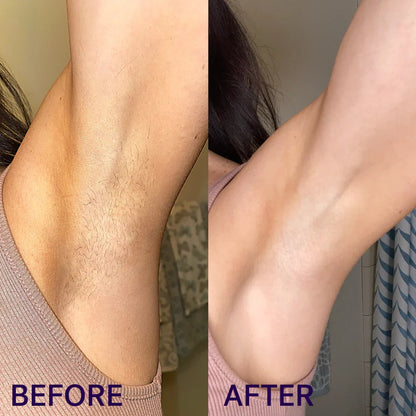 Gentle Hair Removal Cream Duo ✨ Smooth Skin, No Pain — Perfect for Sensitive Skin 💜